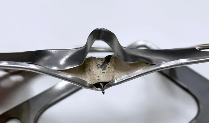 Gasket Material Upgrades
